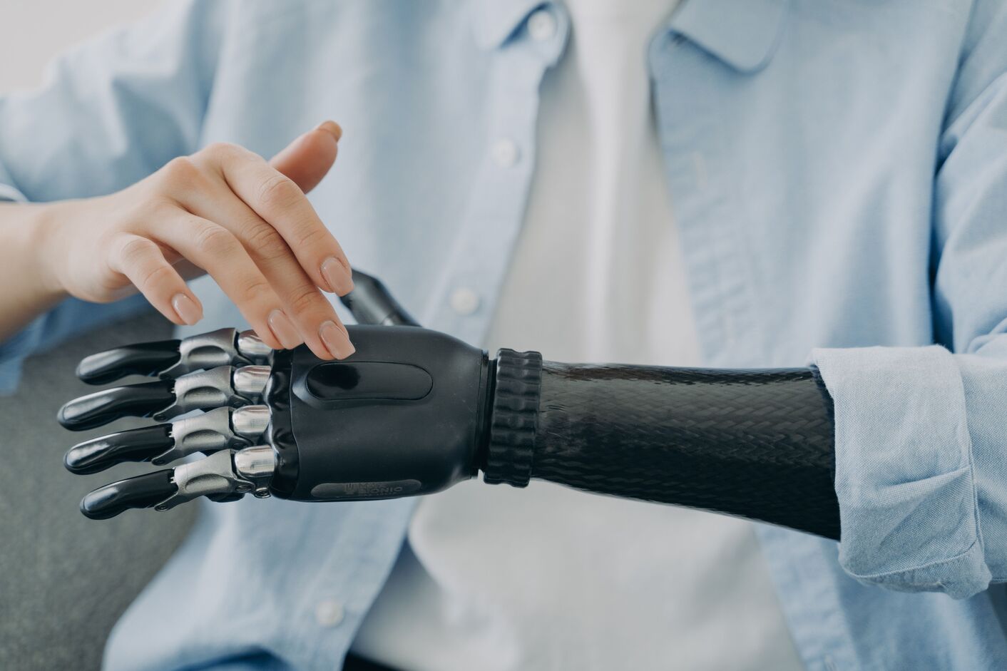 Amputation and Prosthetics
