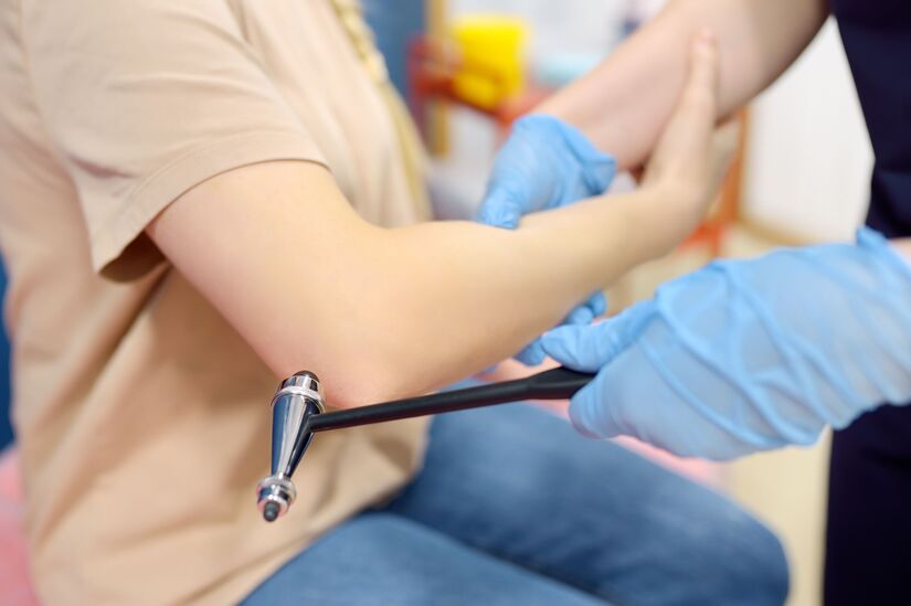Cubital Tunnel Syndrome