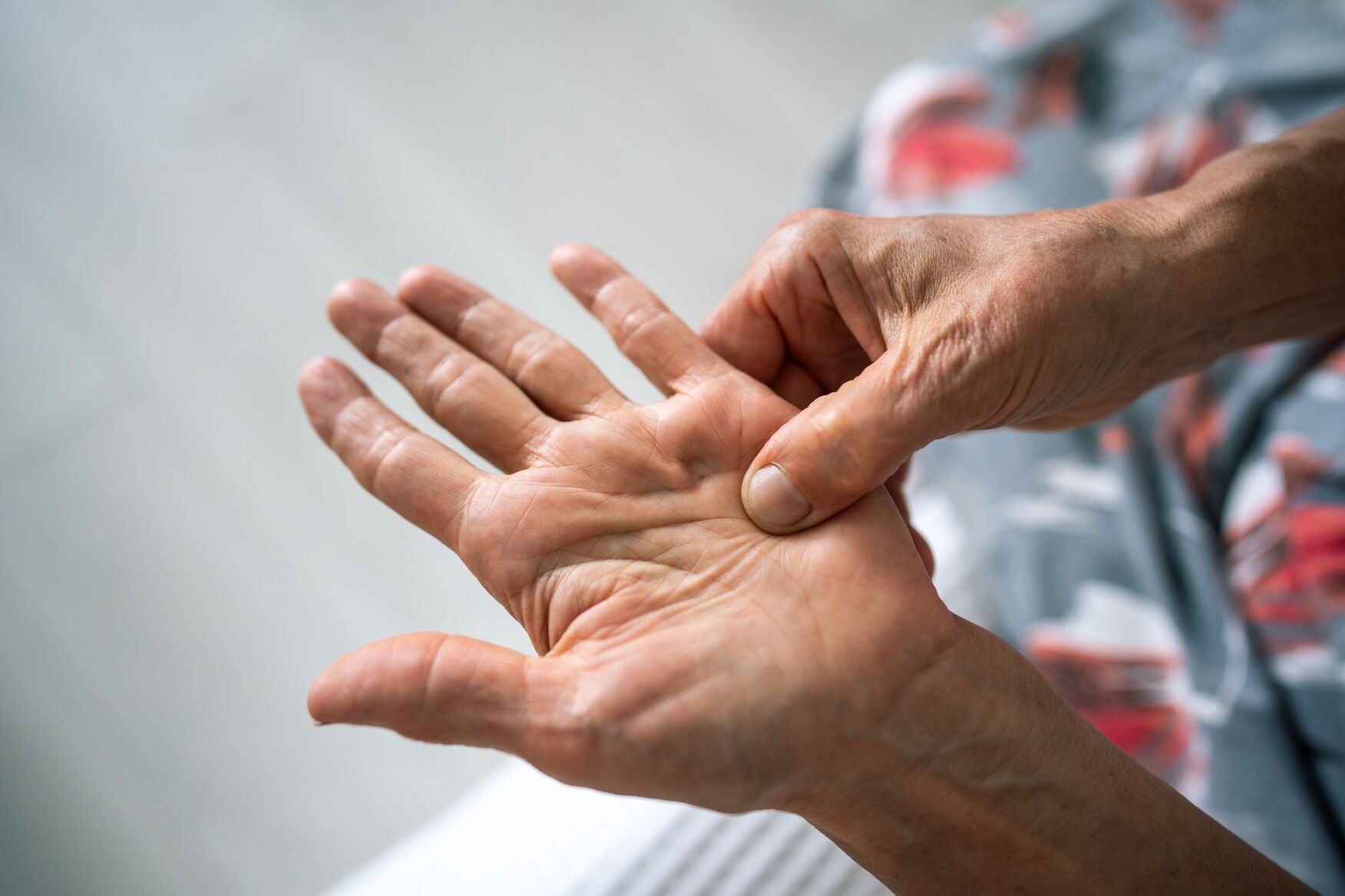 Dupuytren's Contracture