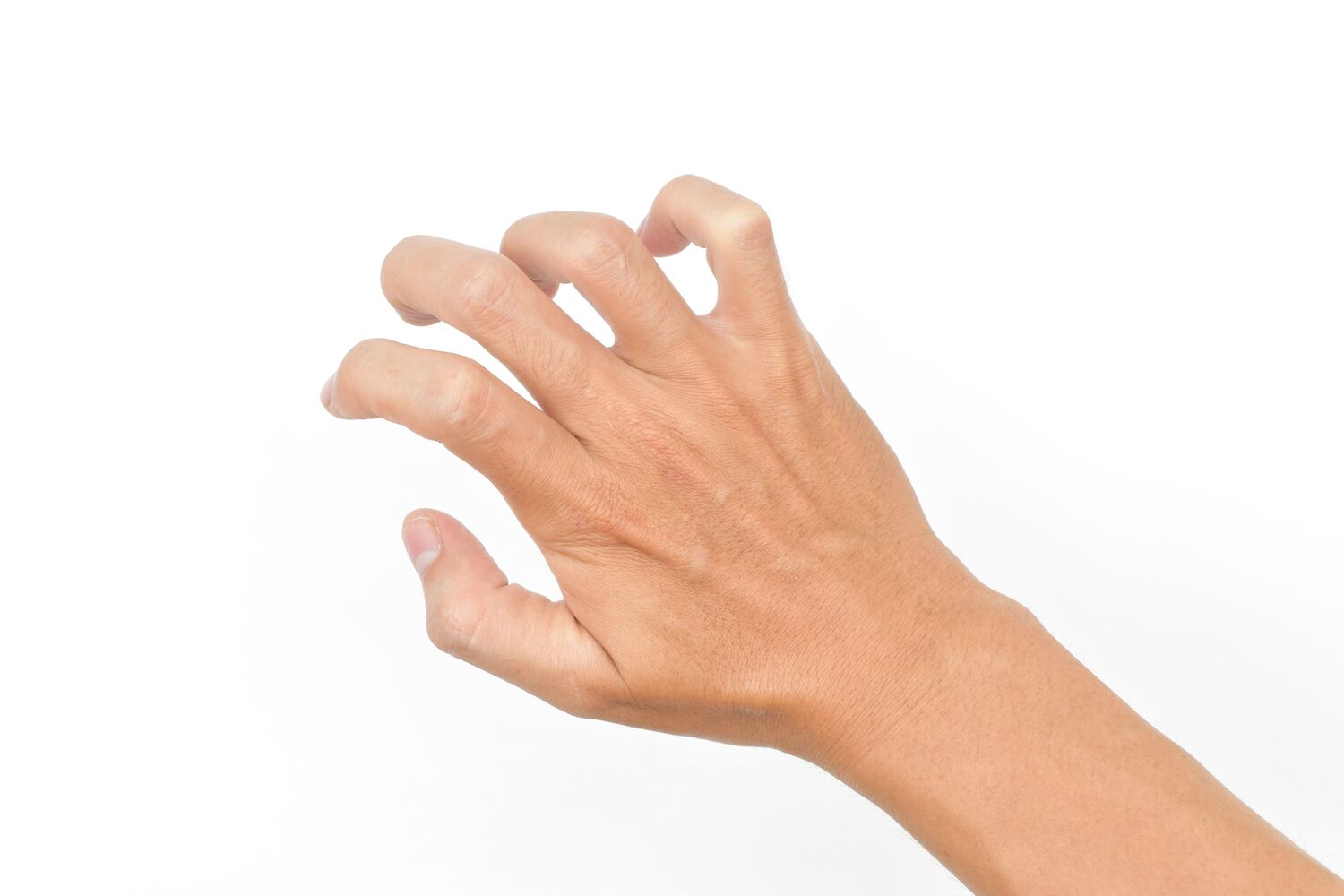 Flexor Tendon Injuries