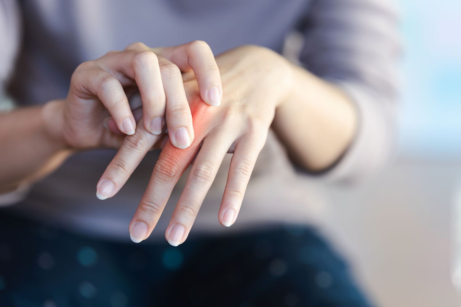 MP Joint Arthritis