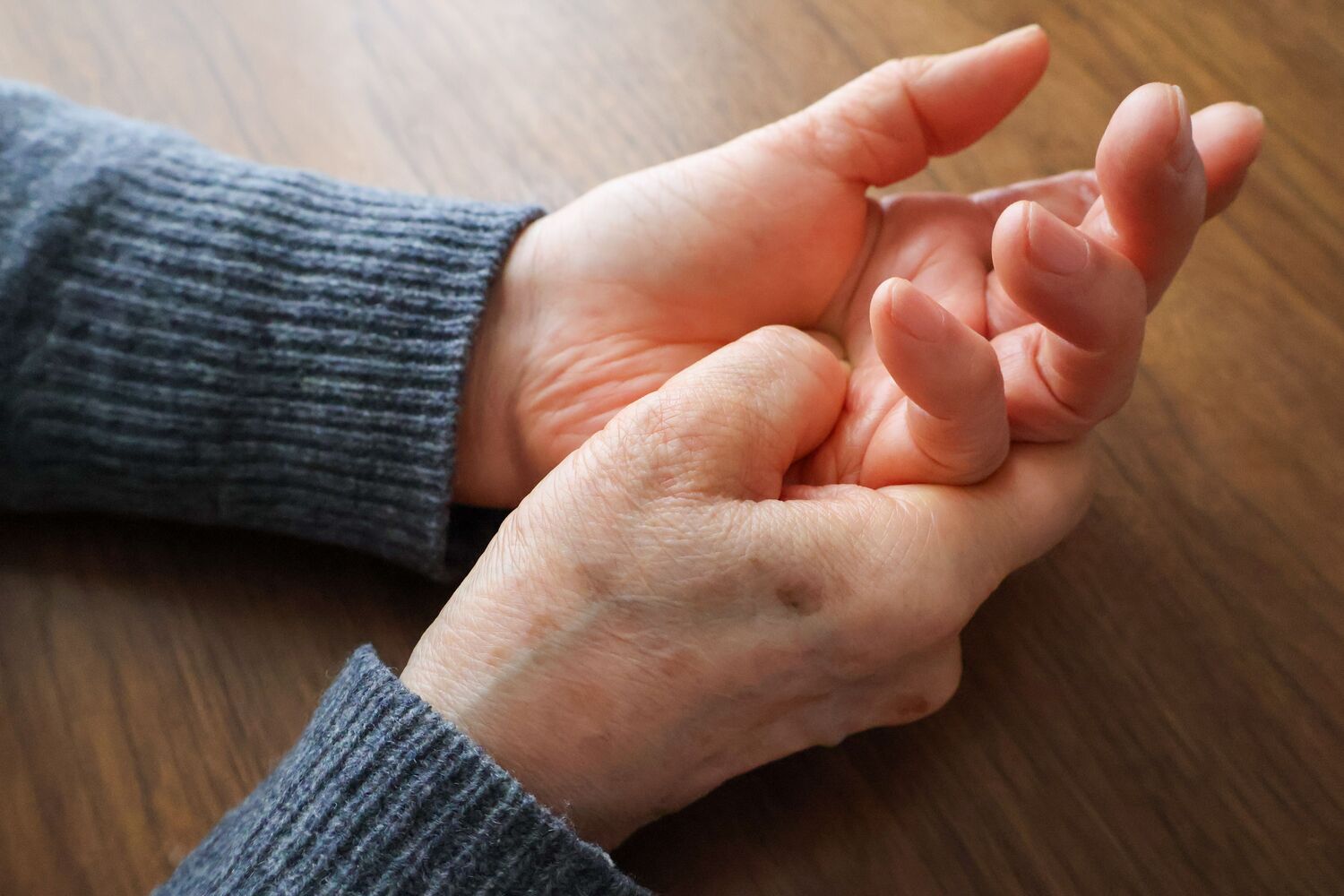 Rheumatoid Disease and the Hand