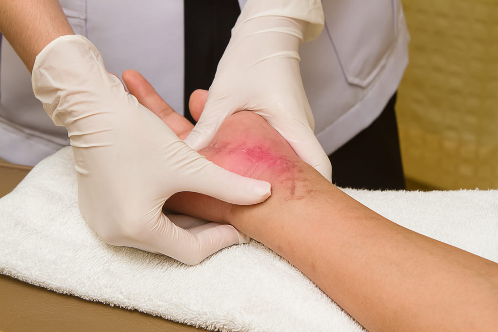 Scar & Swelling Management