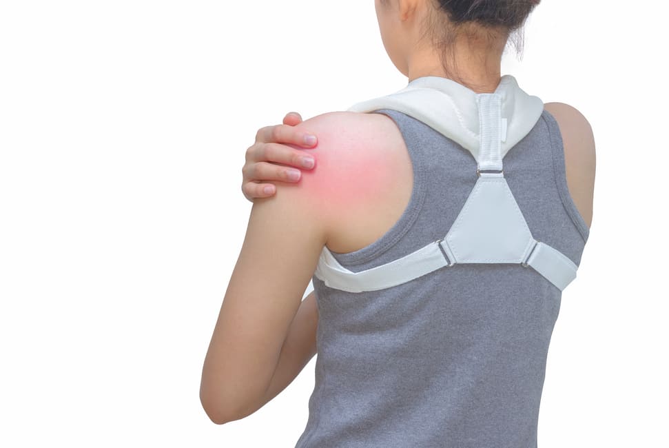 Clavicle Fracture Treatment