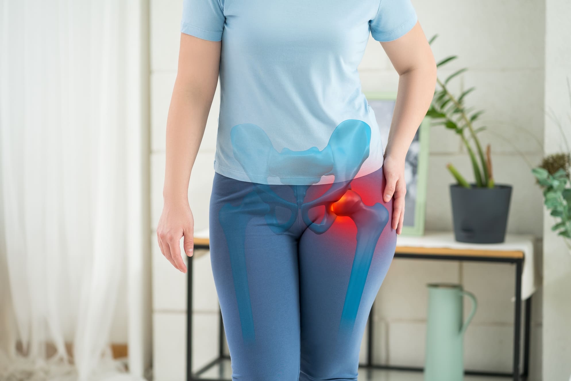 Hip Arthritis Treatment