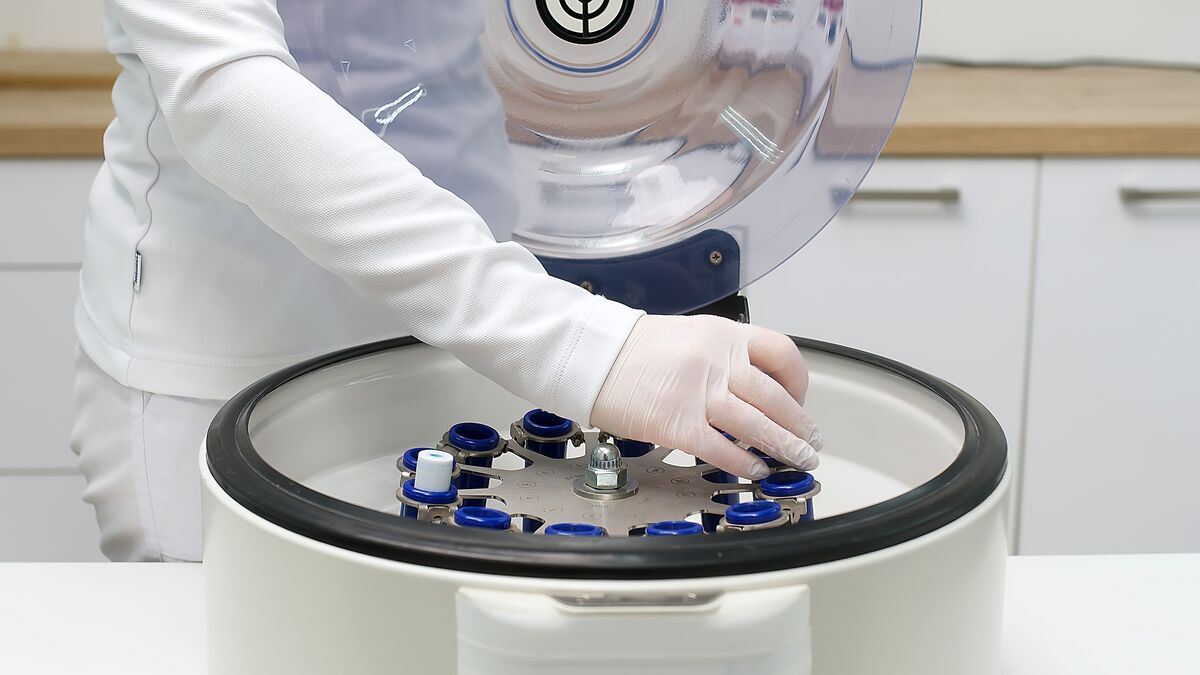 Platelet-Rich Plasma (PRP) Injections