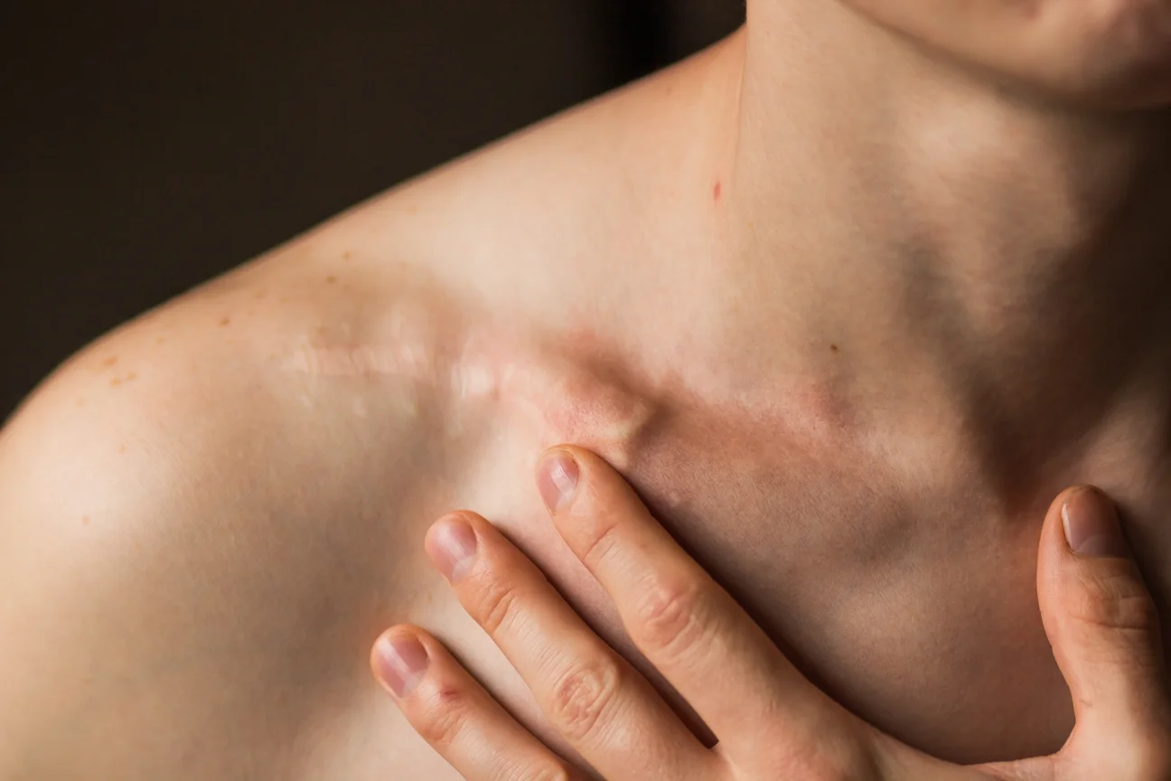 Clavicle Fracture Treatment in Coachella Valley